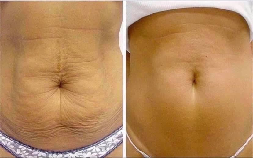 ageLOC® Dermatic Effects® Body Contouring Lotion