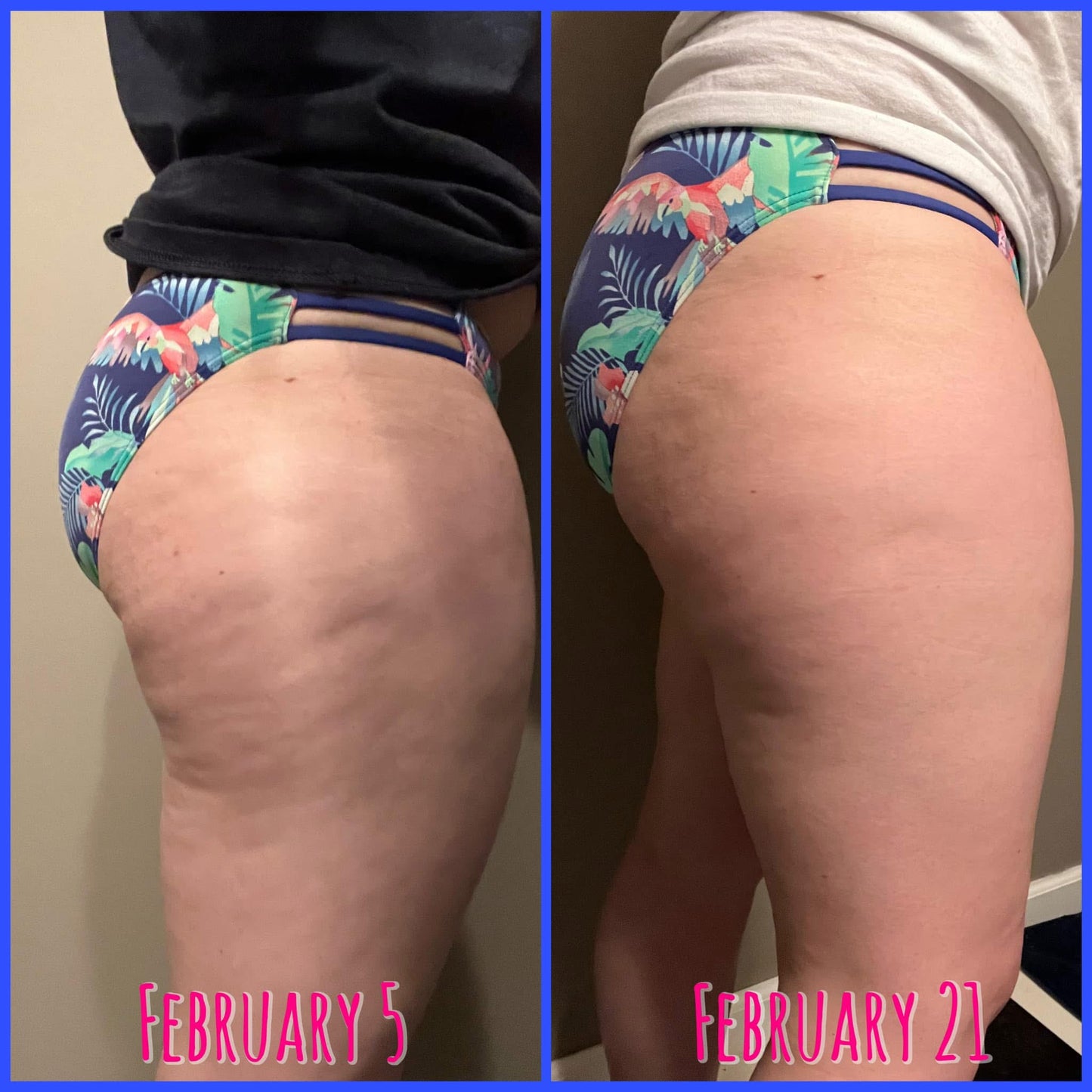 ageLOC® Dermatic Effects® Body Contouring Lotion