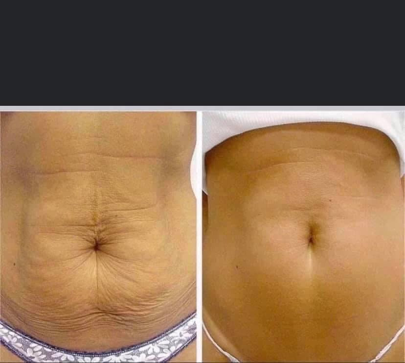 ageLOC® Dermatic Effects® Body Contouring Lotion