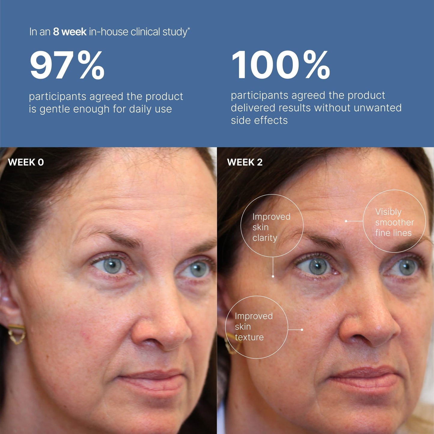 ageLOC® Tru Face® Peptide Retinol Complex