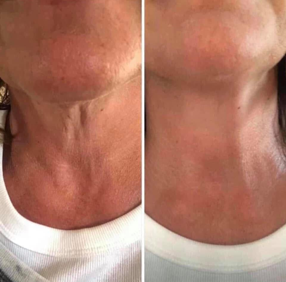 ageLOC® Dermatic Effects® Body Contouring Lotion