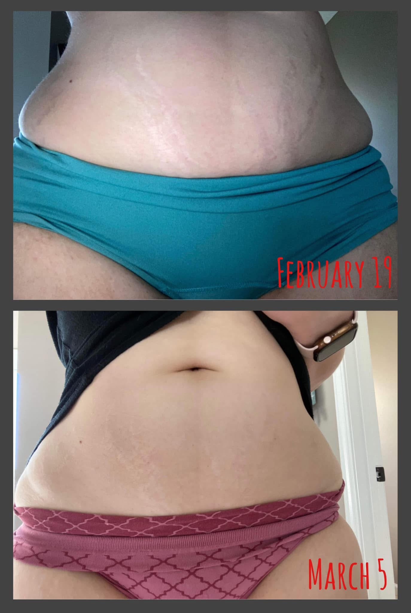 ageLOC® Dermatic Effects® Body Contouring Lotion